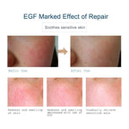 ARTISCARE EGF Face Serum for Skin Care Moisturizing Rejuvenation Cream Facial Oil Control Shrink Pores Essence