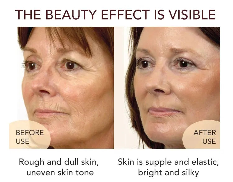 AILKE Whitening Dark Spot Remove Facial Skin Care Cream With Collagen Anti- Freckles Wrinkle Repair Women Premium Face Product