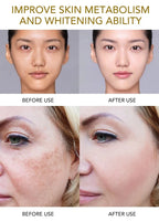 AILKE Whitening Dark Spot Remove Facial Skin Care Cream With Collagen Anti- Freckles Wrinkle Repair Women Premium Face Product