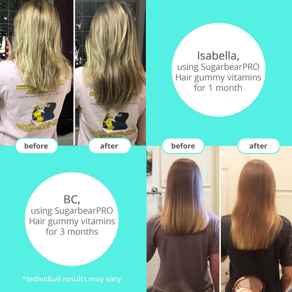 Bear Hair Vitamin Gummy Biotin 6000mcg Multivitamin Supplement Vegan Vitamin Hair, Skin & Nail Growth Gummies for Men & Women