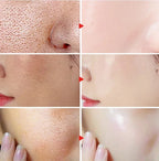 Acidity Pore Shrink Face Serum Remove Blackheads Acne Oil Control Repair Essence Moisturizing Nourish Pores Firming Facial Care
