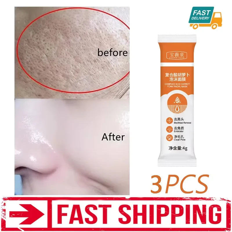 Acidity Pore Shrink Face Serum Remove Blackheads Acne Oil Control Repair Essence Moisturizing Nourish Pores Firming Facial Care