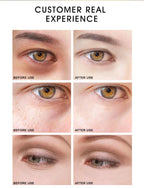 ARTISCARE 24K Gold SkinCare SET Face Cream Moisturizing Serum Dark Circles Essence Korean Skin Care Products