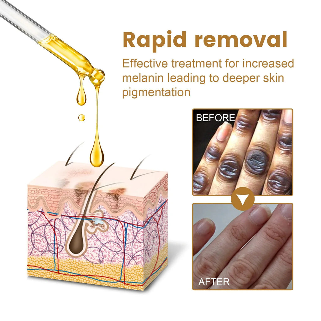 Dark Knuckles Fast Brighten Serum Elbows Hand Knuckle Brightening Serum Knee Black Skin Quickly Lighten Stains Remover Essence