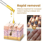 Dark Knuckles Fast Brighten Serum Elbows Hand Knuckle Brightening Serum Knee Black Skin Quickly Lighten Stains Remover Essence