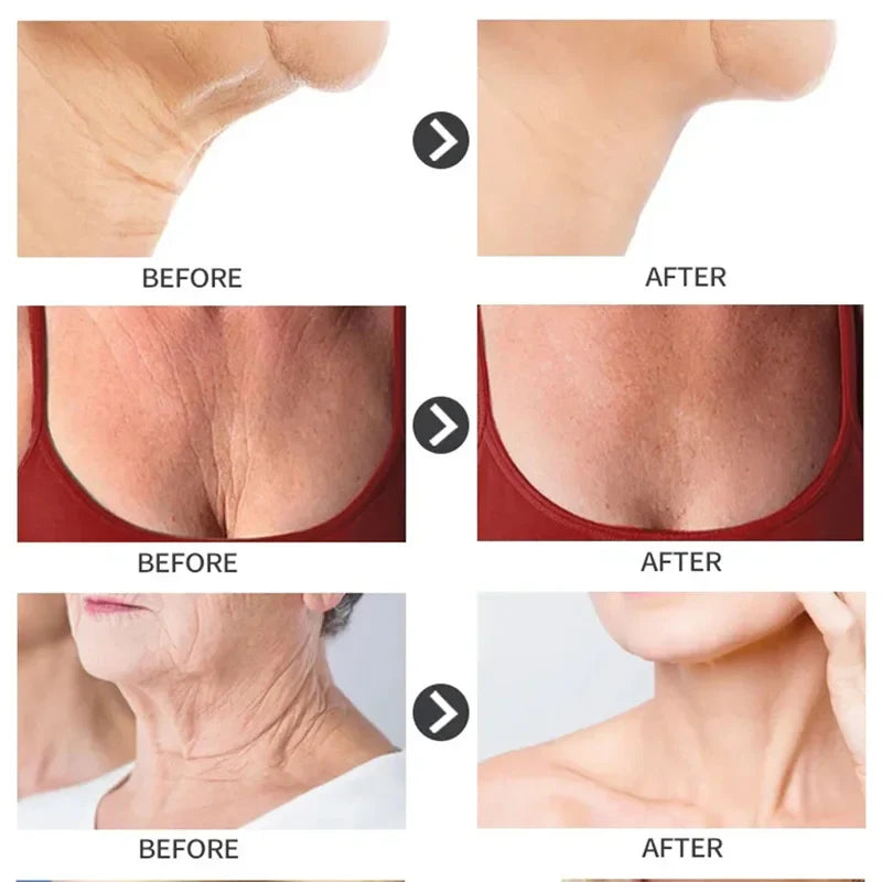 10PCS Collagen Anti Wrinkle Neck Mask Anti Aging Fade Fine Lines Firm Skin Moisturizing Brighten Rejuvenating SkinCare Cosmetics