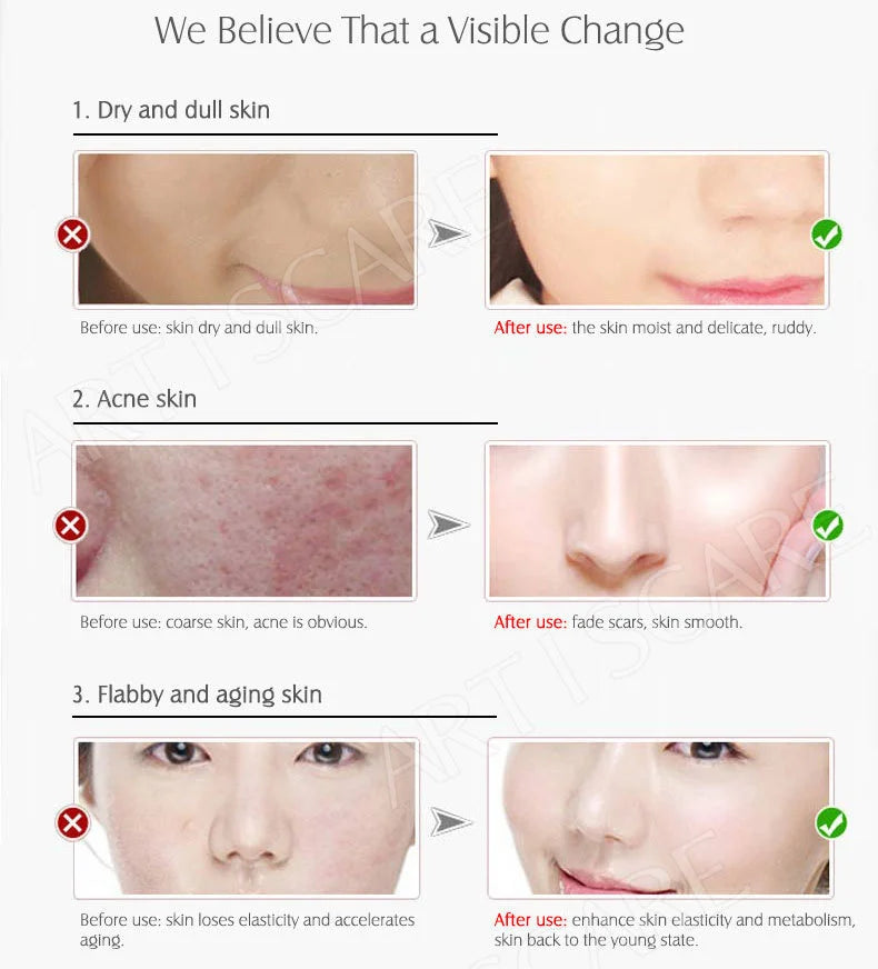 ARTISCARE Vitamin C Serum for Face Moisturizing 4Pcs Hyaluron Acid Facial Care Nourishing Essence SkinCare Products