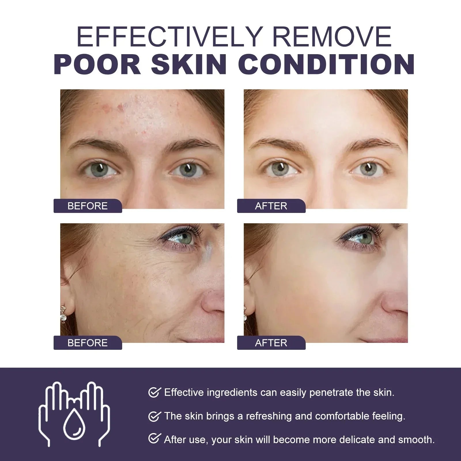 Dark Spots Remover Whitening Serum Face Freckle Melanin Correcting Anti Pigmentation Brighten Beauty Korean Day Night Skin Care