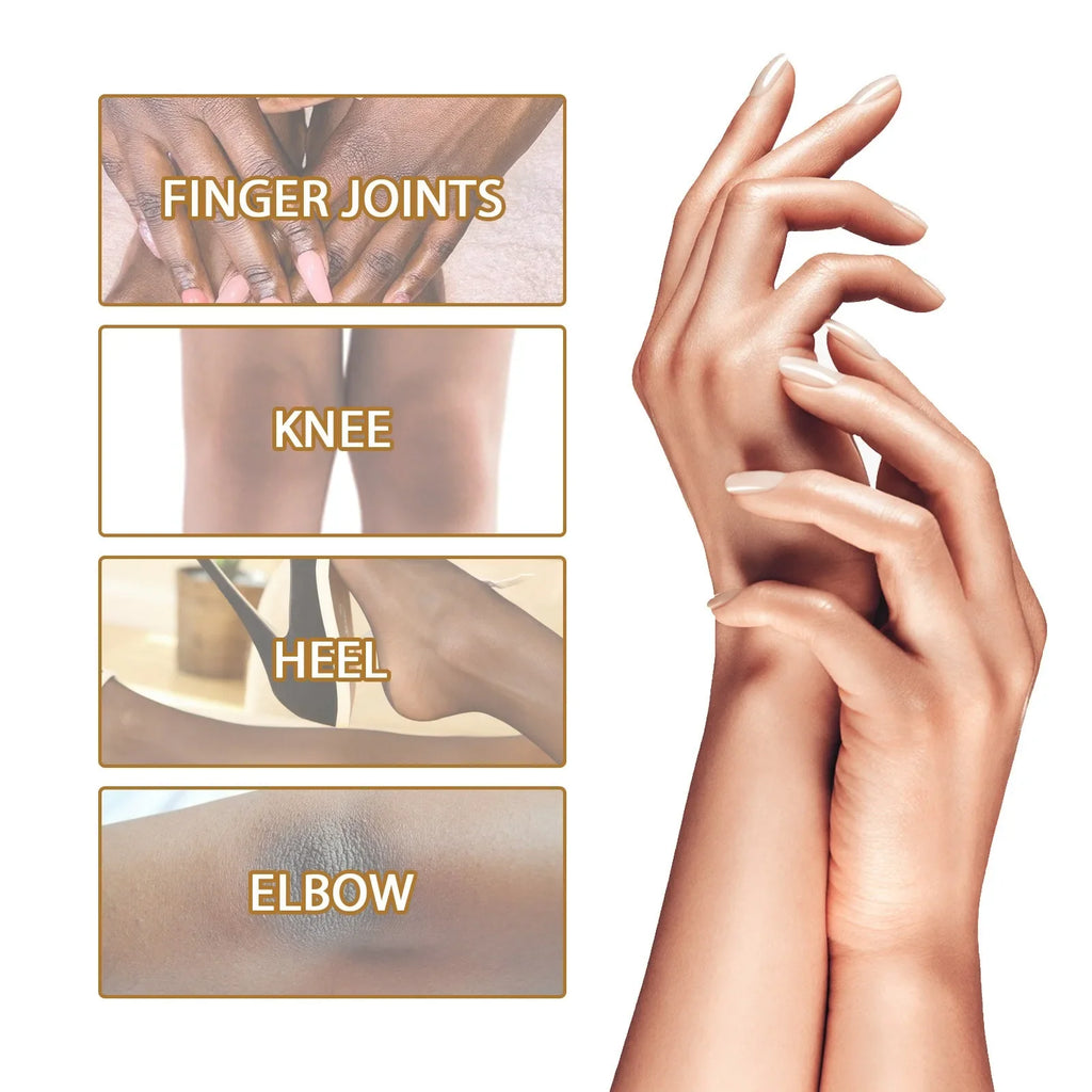 Dark Knuckles Fast Brighten Serum Elbows Hand Knuckle Brightening Serum Knee Black Skin Quickly Lighten Stains Remover Essence