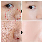 Acidity Pore Shrink Face Serum Remove Blackheads Acne Oil Control Repair Essence Moisturizing Nourish Pores Firming Facial Care