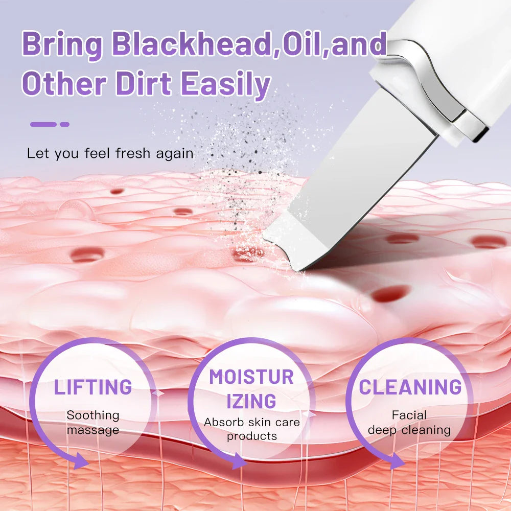 Electric Ultrasonic Skin Scrubber Vibration Face Spatula Peeling Blackhead Remover Facial Lifting Cleansing Ultrasonic Skin Care