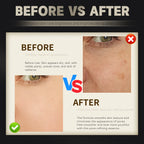 2025 New Korean Hyaluronic Acid Serum Anti-aging Moisturizing Skin Care Repair Essence 5MLx10Vials