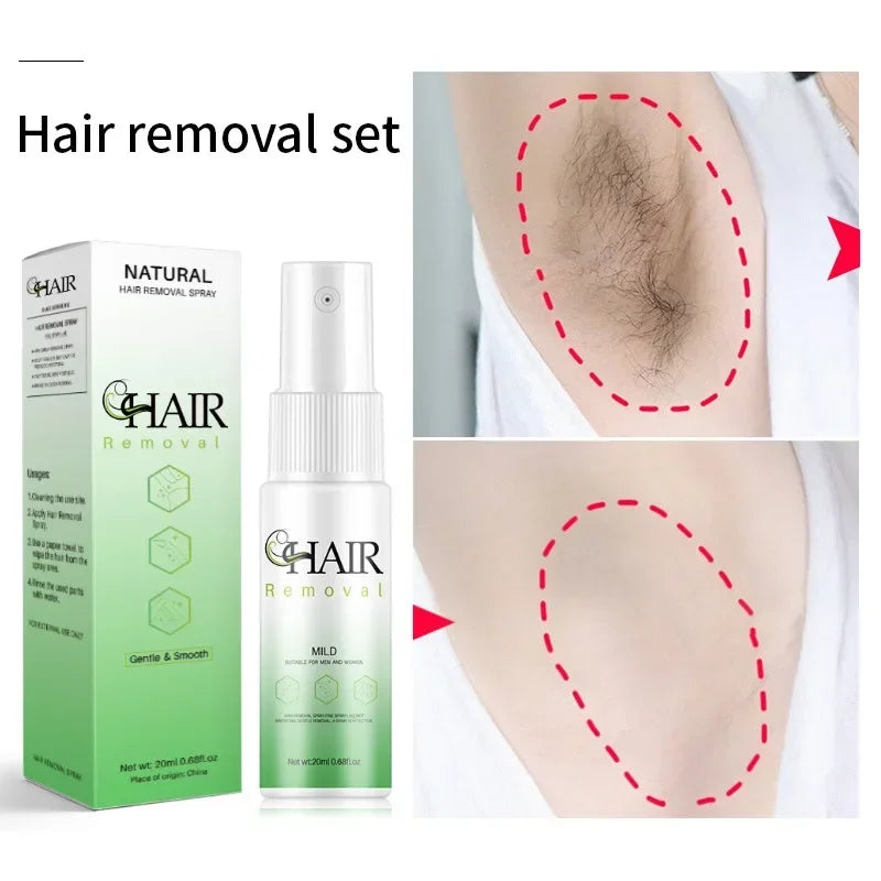 2 Minutes Fast Hair Removal Spray Painless Hair Growth Inhibitor Arm Armpit Leg Permanent Depilatory for Men Women Repair Care