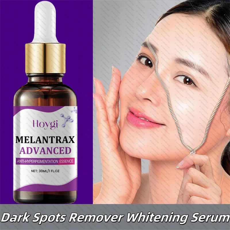 Dark Spots Remover Whitening Serum Face Freckle Melanin Correcting Anti Pigmentation Brighten Beauty Korean Day Night Skin Care