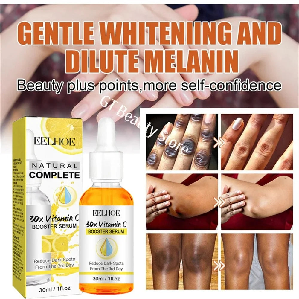 Dark Knuckles Fast Brighten Serum Elbows Hand Knuckle Brightening Serum Knee Black Skin Quickly Lighten Stains Remover Essence