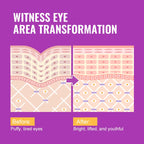 AUQUEST Anti Dark Circles Eye Serum Eye Bags Removal Caffeine Eye Cream Fade Fine Line Hyaluronic Acid Anti-Puffiness Skin Care