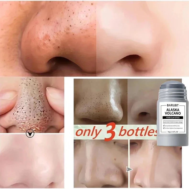 Alaska Volcano Mask Mugwort Cleansing Mask Stick Shrink Pores Acne Deep Blackhead Remover Facial Cleansing Moisturizing Mask 40g