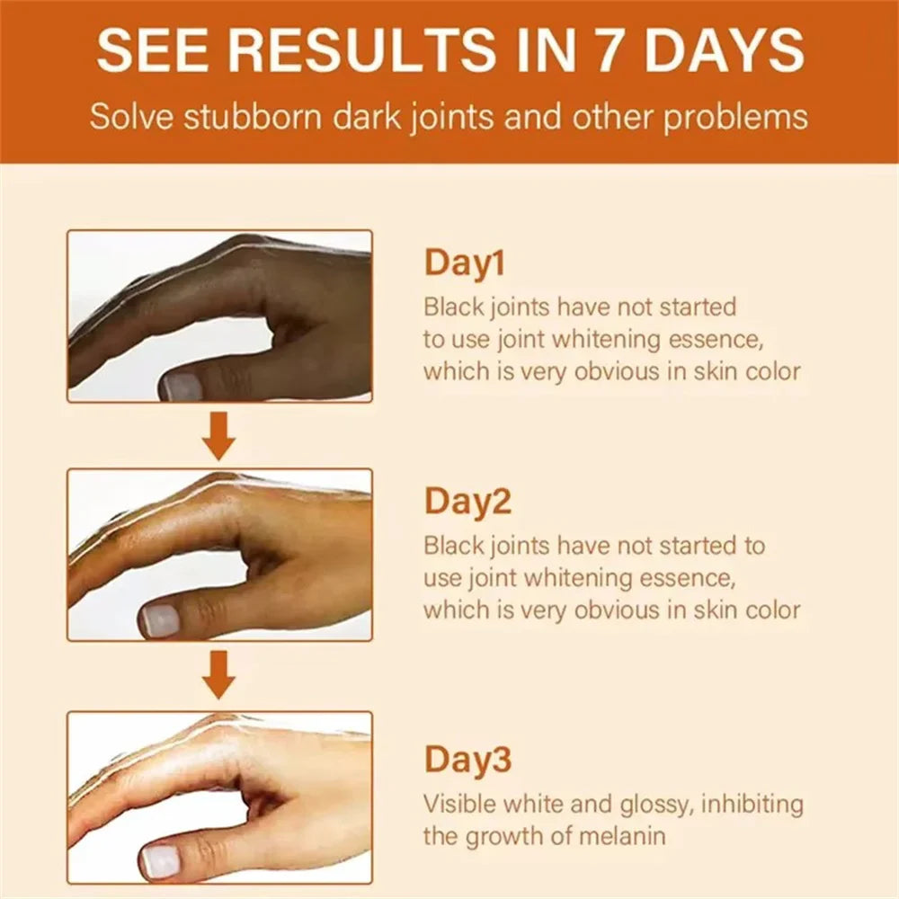 Dark Knuckles Fast Brighten Serum Elbows Hand Knuckle Brightening Serum Knee Black Skin Quickly Lighten Stains Remover Essence
