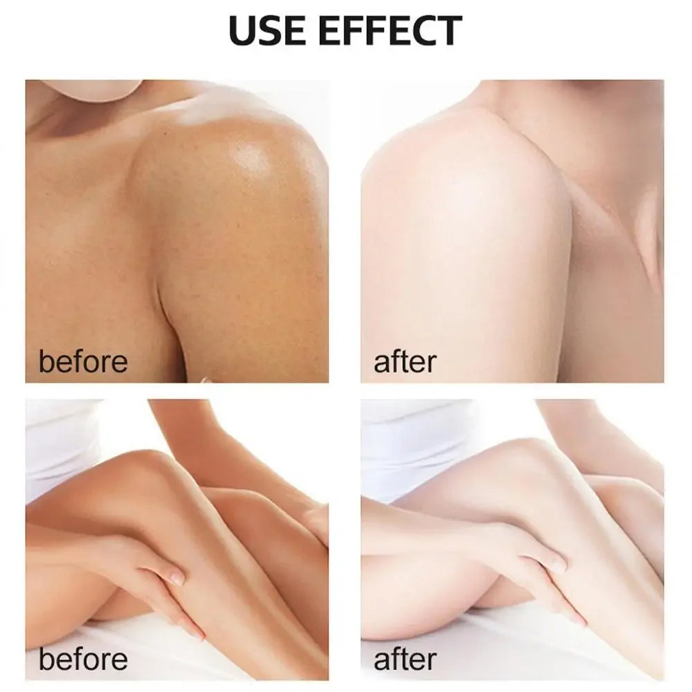 Body Care Exfoliating Yellow Peeling Oil 100% Organic Bleaching Dark Skin Serum Dark Knuckles Fast Whitening Cosmetics