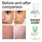GZE Vegetable Glycerin, 100% Pure, Versatile Skin Care, Softening and Moisturizing, Multi-PURPOSE AND VERSATILE SKIN CARE