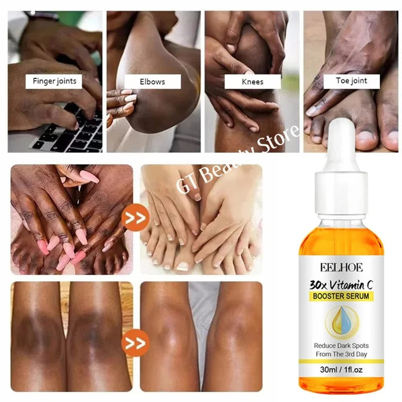 Dark Knuckles Fast Brighten Serum Elbows Hand Knuckle Brightening Serum Knee Black Skin Quickly Lighten Stains Remover Essence