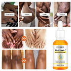 Dark Knuckles Fast Brighten Serum Elbows Hand Knuckle Brightening Serum Knee Black Skin Quickly Lighten Stains Remover Essence