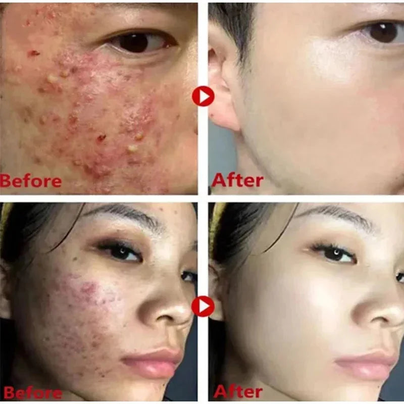 Green Tea Remove Blackhead Solid Mask Dispel Acne Blemish Cleansing Stick Mask Shrink Pores Tighten Whitening Repair Skin Care