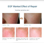 ARTISCARE EGF Face Serum for Skin Care Moisturizing Rejuvenation Cream Facial Oil Control Shrink Pores Essence