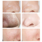 Acidity Pore Shrink Face Serum Remove Blackheads Acne Oil Control Repair Essence Moisturizing Nourish Pores Firming Facial Care