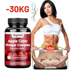 Apple Cider Vinegar - Improves Digestion, Appetite Suppression,Weight Management, Relieves Bloating - 120 Capsules