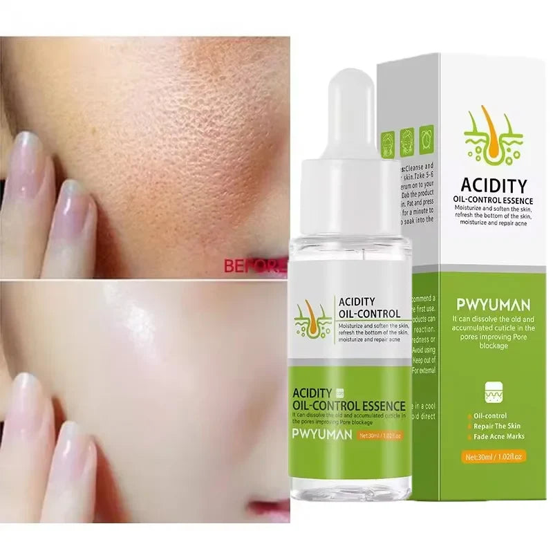 Acidity Pore Shrink Face Serum Remove Blackheads Acne Oil Control Repair Essence Moisturizing Nourish Pores Firming Facial Care