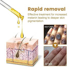 Dark Knuckles Fast Brighten Serum Elbows Hands Knee Armpits Brightening Serum Clarify Black Skin Lighten Stains Remover Essence