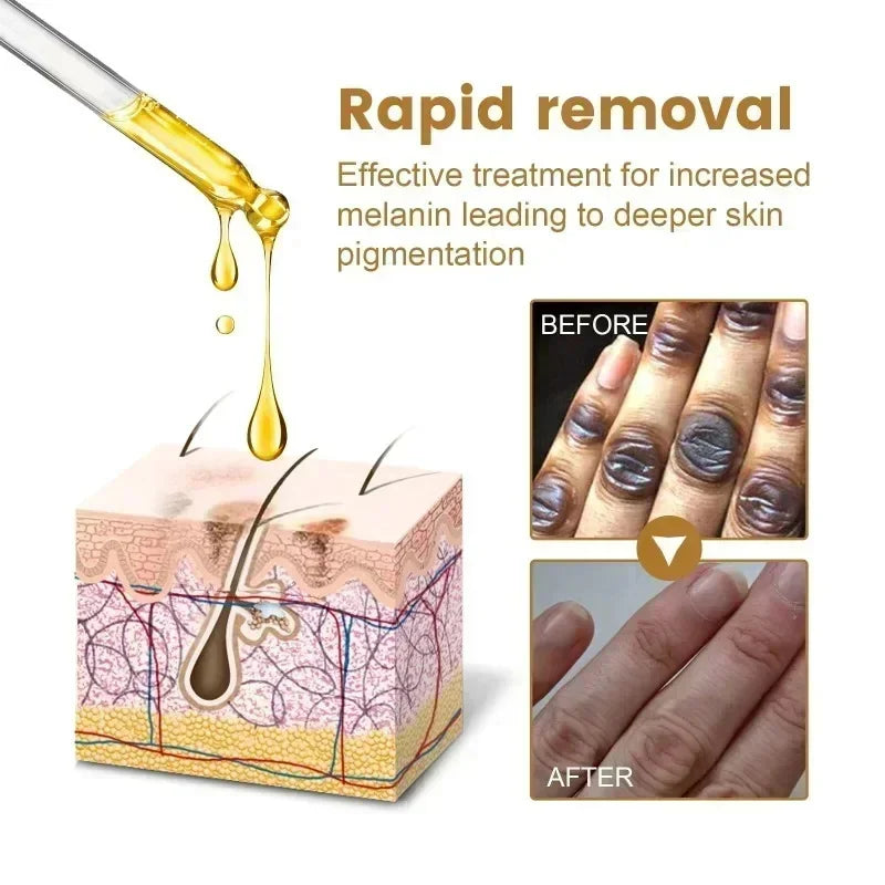 Dark Knuckles Fast Brighten Serum Elbows Hands Knee Armpits Brightening Serum Clarify Black Skin Lighten Stains Remover Essence