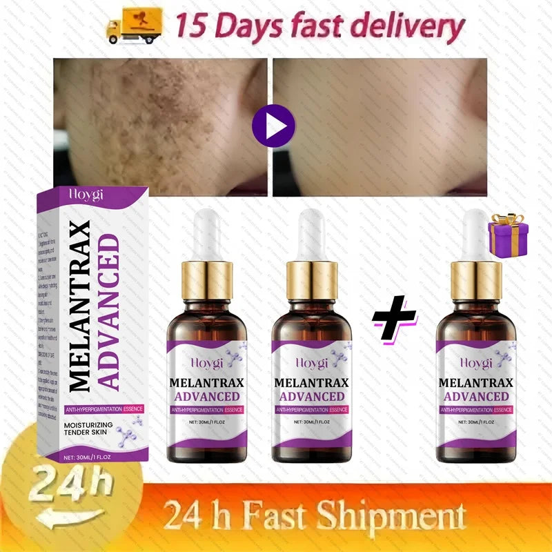 Dark Spots Remover Whitening Serum Face Freckle Melanin Correcting Anti Pigmentation Brighten Beauty Korean Day Night Skin Care