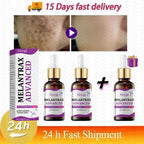 Dark Spots Remover Whitening Serum Face Freckle Melanin Correcting Anti Pigmentation Brighten Beauty Korean Day Night Skin Care