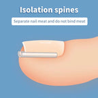 50Pcs Ingrown Toenail Correction Tool Ingrown Toe Nail Treatment Elastic Patch Sticker Straightening Clip Brace Pedicure Tool