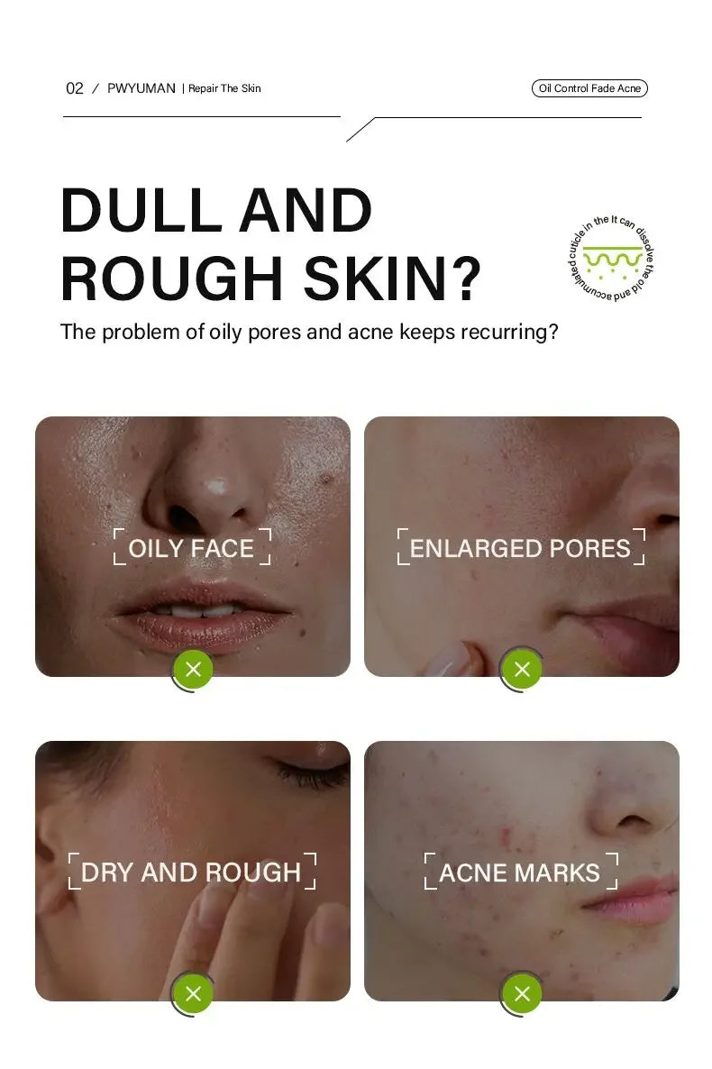 Acidity Pore Shrink Face Serum Remove Blackheads Acne Oil Control Repair Essence Moisturizing Nourish Pores Firming Facial Care