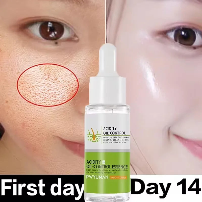 Acidity Pore Shrink Face Serum Remove Blackheads Acne Oil Control Repair Essence Moisturizing Nourish Pores Firming Facial Care