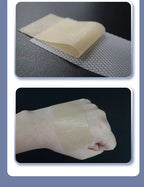 4x15cm 3pcs Silicone Scar sheet Self-Adhesive Scar Cover Tape Scalable for Burn Injury C-Section Keloid Skin Care