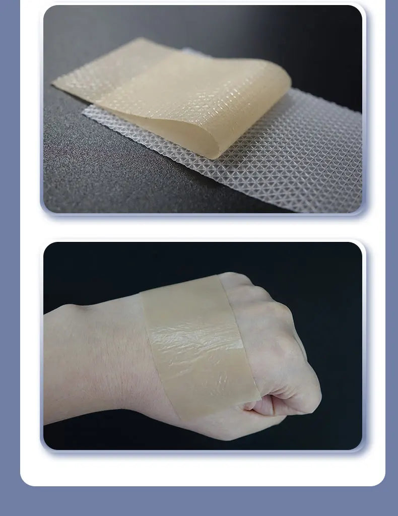 4x15cm 3pcs Silicone Scar sheet Self-Adhesive Scar Cover Tape Scalable for Burn Injury C-Section Keloid Skin Care