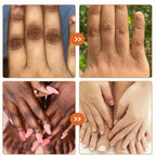 Dark Knuckles Fast Brighten Serum Elbows Hand Knuckle Brightening Serum Knee Black Skin Quickly Lighten Stains Remover Essence