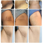 Dark Knuckles Fast Brighten Serum Elbows Hand Knuckle Brightening Serum Knee Black Skin Quickly Lighten Stains Remover Essence