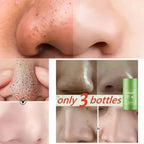 Green Tea Remove Blackhead Solid Mask Dispel Acne Blemish Cleansing Stick Mask Shrink Pores Tighten Whitening Repair Skin Care
