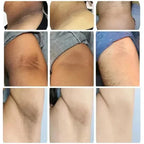 Dark Knuckles Fast Brighten Serum Elbows Hands Knee Armpits Brightening Serum Clarify Black Skin Lighten Stains Remover Essence