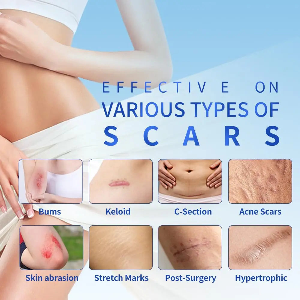 4x15cm 3pcs Silicone Scar sheet Self-Adhesive Scar Cover Tape Scalable for Burn Injury C-Section Keloid Skin Care