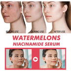 1/3pcs Watermelon nicotinamide Light Bulb serum deep Moisturizing Skin Brightening Face lightning Essence skin care for women