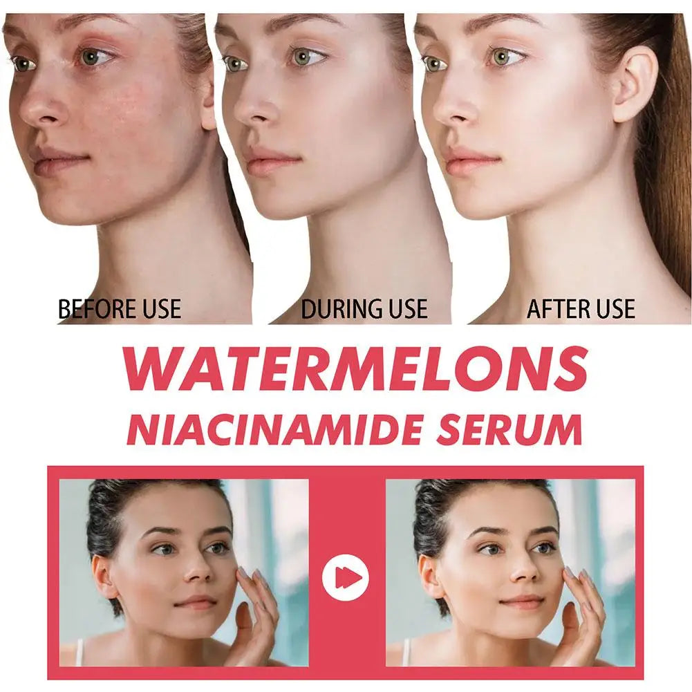 1/3pcs Watermelon nicotinamide Light Bulb serum deep Moisturizing Skin Brightening Face lightning Essence skin care for women
