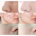 Alaska Volcano Mask Mugwort Cleansing Mask Stick Shrink Pores Acne Deep Blackhead Remover Facial Cleansing Moisturizing Mask 40g