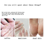 Disc For Pedicure Cuticle Callus Remove Tool For Electric Foot File Callus Hard Dead Skin Pedicure Tools Replaceable Sandpaper